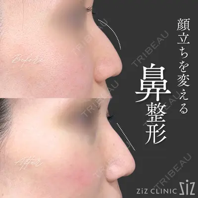 ziz CLINIC 村岡 史子医師の症例