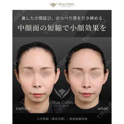 Otus Clinic 【オータスクリニック】 中 徳太郎医師の症例