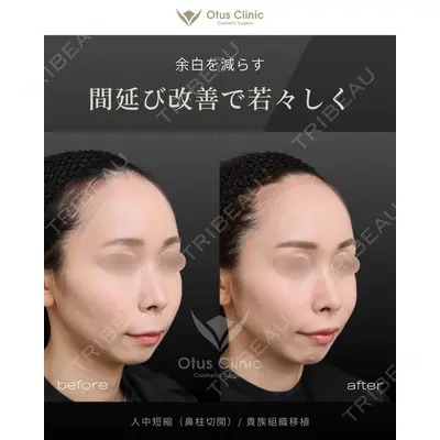 Otus Clinic 【オータスクリニック】 中 徳太郎医師の症例