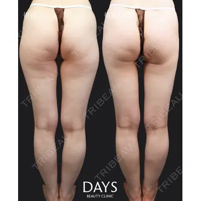Days Beauty Clinic 本厚木院の症例
