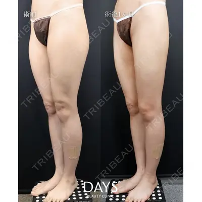 Days Beauty Clinic 本厚木院の症例