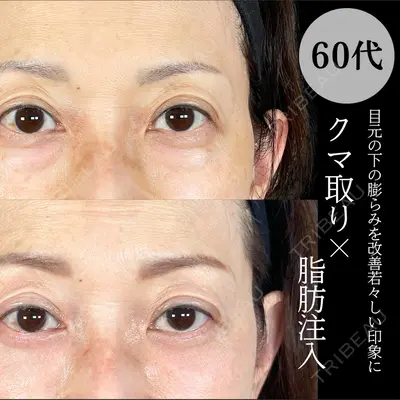 アリエル美容クリニック 大宮院 鈴木　桂介医師の症例