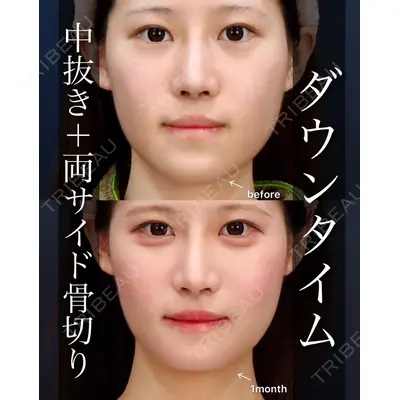KIHARU CLINIC 藤岡菜月医師の症例