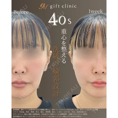 gift clinic 能登谷 翔医師の症例