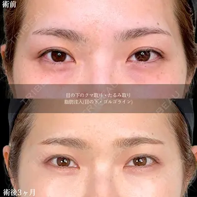 アリエル美容クリニック 水戸院 天白 典秀医師の症例