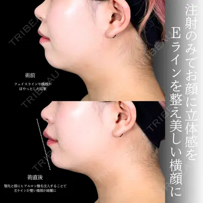 アリエル美容クリニック 大宮院 宮下宝樹医師の症例