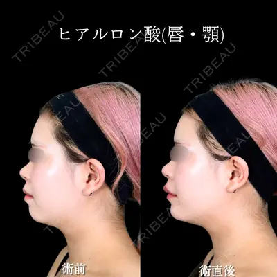 アリエル美容クリニック 大宮院 宮下宝樹医師の症例