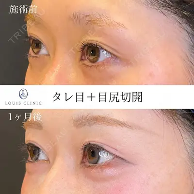 LOUIS CLINIC 二子玉川院【ルイクリニック】 小松 塁医師の症例
