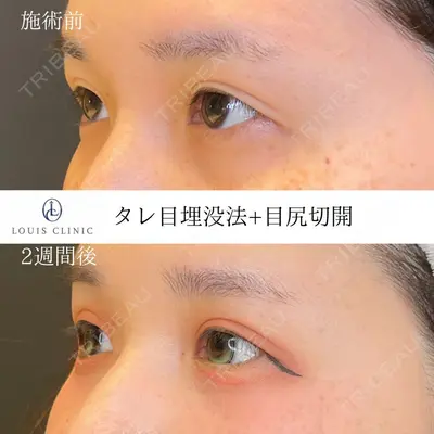 LOUIS CLINIC 二子玉川院【ルイクリニック】 小松 塁医師の症例