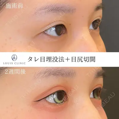 LOUIS CLINIC 二子玉川院【ルイクリニック】 小松 塁医師の症例