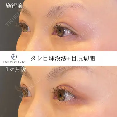 LOUIS CLINIC 二子玉川院【ルイクリニック】 小松 塁医師の症例