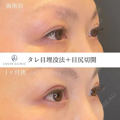 LOUIS CLINIC 二子玉川院【ルイクリニック】 小松 塁医師の症例