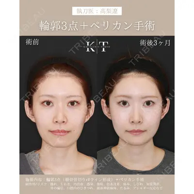KAI CLINIC TOKYO（カイクリニック東京） 髙梨 遼医師の症例