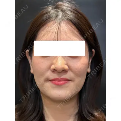 Ledian Clinic六本木 奥村 瞬医師の症例