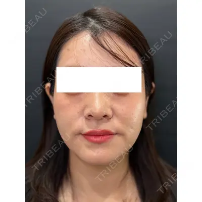 Ledian Clinic六本木 奥村 瞬医師の症例
