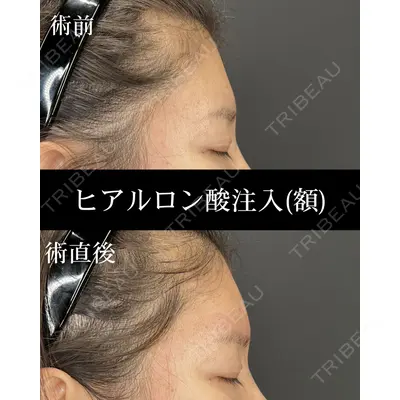 HAAB×DREAM BEAUTY CLINIC 大阪梅田院 柏木 太雅医師の症例