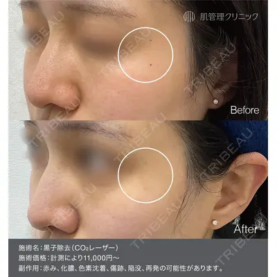 肌管理クリニックの症例