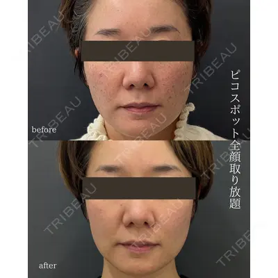 銀座美容外科クリニック 銀座院の症例