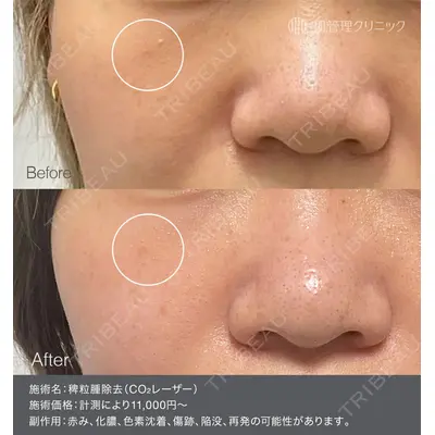 肌管理クリニックの症例