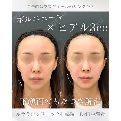 ルラ美容クリニック 札幌本院 田中 瑞希医師の症例