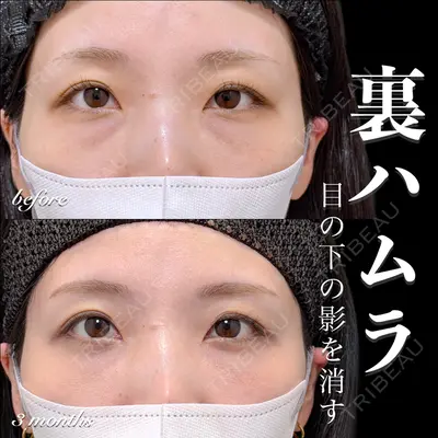 EMMO FACE CLINIC 大宮院 百瀬 直也医師の症例