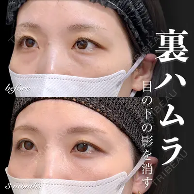 EMMO FACE CLINIC 大宮院 百瀬 直也医師の症例