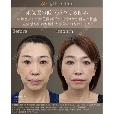 gift clinic 能登谷 翔医師の症例