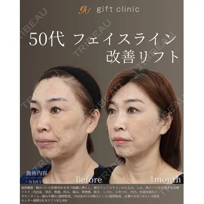 gift clinic 能登谷 翔医師の症例