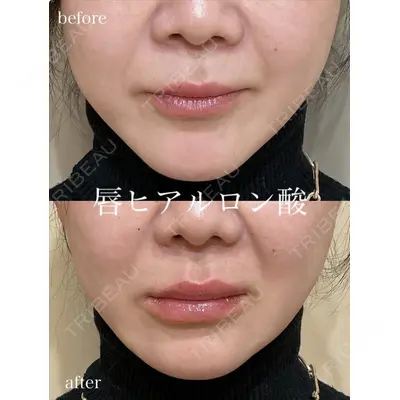アデル美容クリニック 青柳 慶憲医師の症例