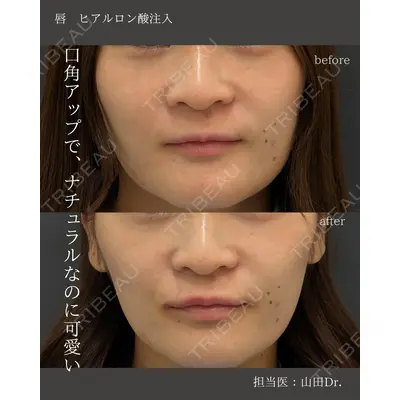 銀座美容外科クリニック 銀座院 山田 理史医師の症例