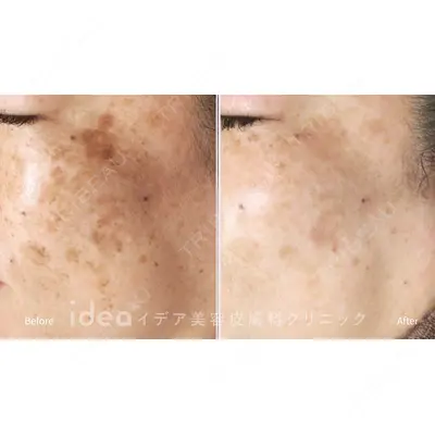 イデア美容皮膚科クリニック 柏院の症例