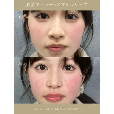 ルラ美容クリニック 岡山院 橋本 晃典医師の症例