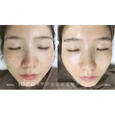 イデア美容皮膚科クリニック 柏院の症例