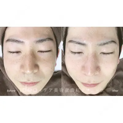 イデア美容皮膚科クリニック 柏院の症例