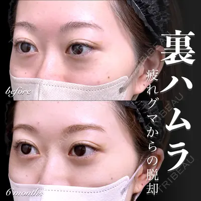 EMMO FACE CLINIC 大宮院 百瀬 直也医師の症例