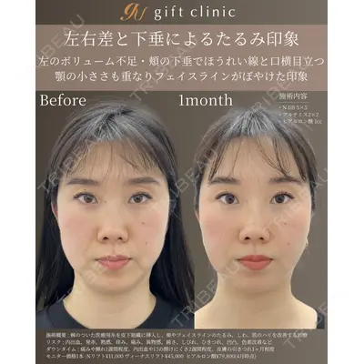 gift clinic 能登谷 翔医師の症例