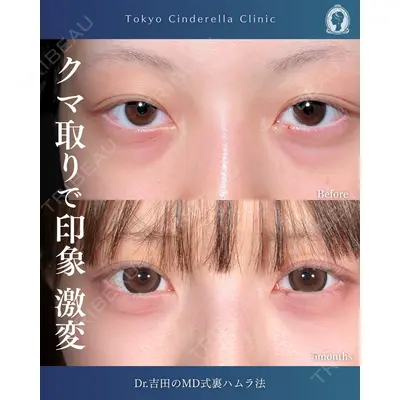 東京シンデレラ美容外科  横浜院 吉田 利之医師の症例