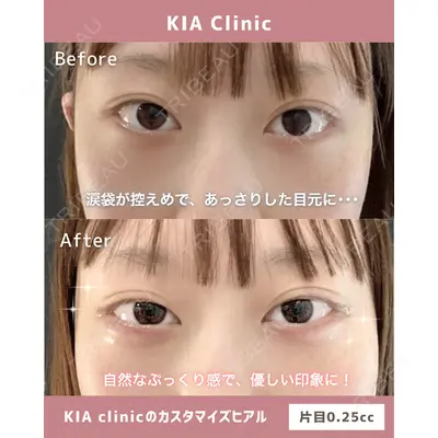KIA CLINIC 心斎橋院 雲山　盛秀医師の症例