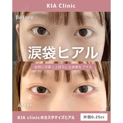 KIA CLINIC 心斎橋院 雲山　盛秀医師の症例