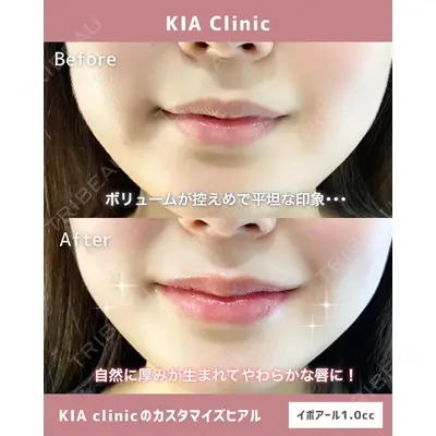 KIA CLINIC 心斎橋院 雲山　盛秀医師の症例