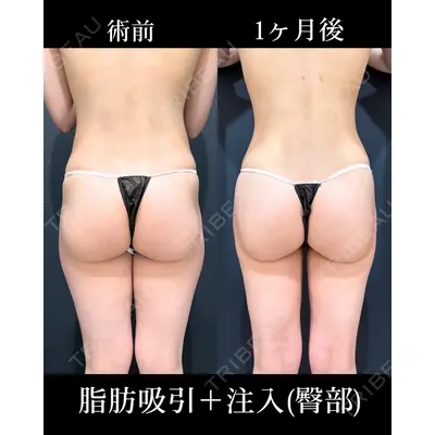 HAAB×DREAM BEAUTY CLINIC 東京本院 吉岡 修一医師の症例