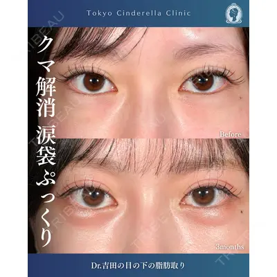 東京シンデレラ美容外科  横浜院 吉田 利之医師の症例
