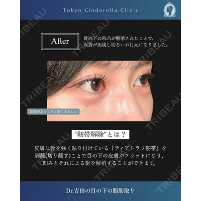 東京シンデレラ美容外科  横浜院 吉田 利之医師の症例
