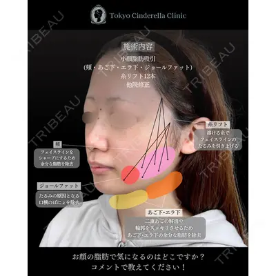 東京シンデレラ美容外科 池袋院 石井 達也医師の症例