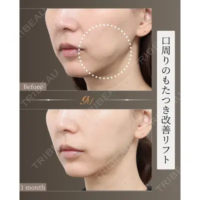 gift clinic 能登谷 翔医師の症例
