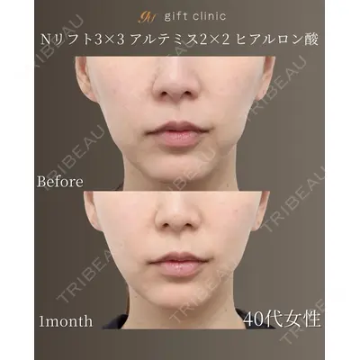 gift clinic 能登谷 翔医師の症例