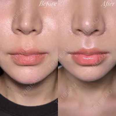 R Beauty CLINIC 大阪院 小池 泰弘医師の症例