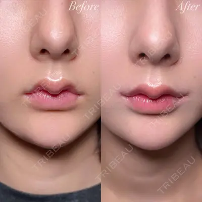 R Beauty CLINIC 大阪院 小池 泰弘医師の症例