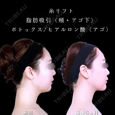 アリエル美容クリニック 水戸院 天白 典秀医師の症例