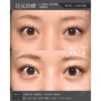KAI CLINIC TOKYO（カイクリニック東京） 上木原 達哉医師の症例